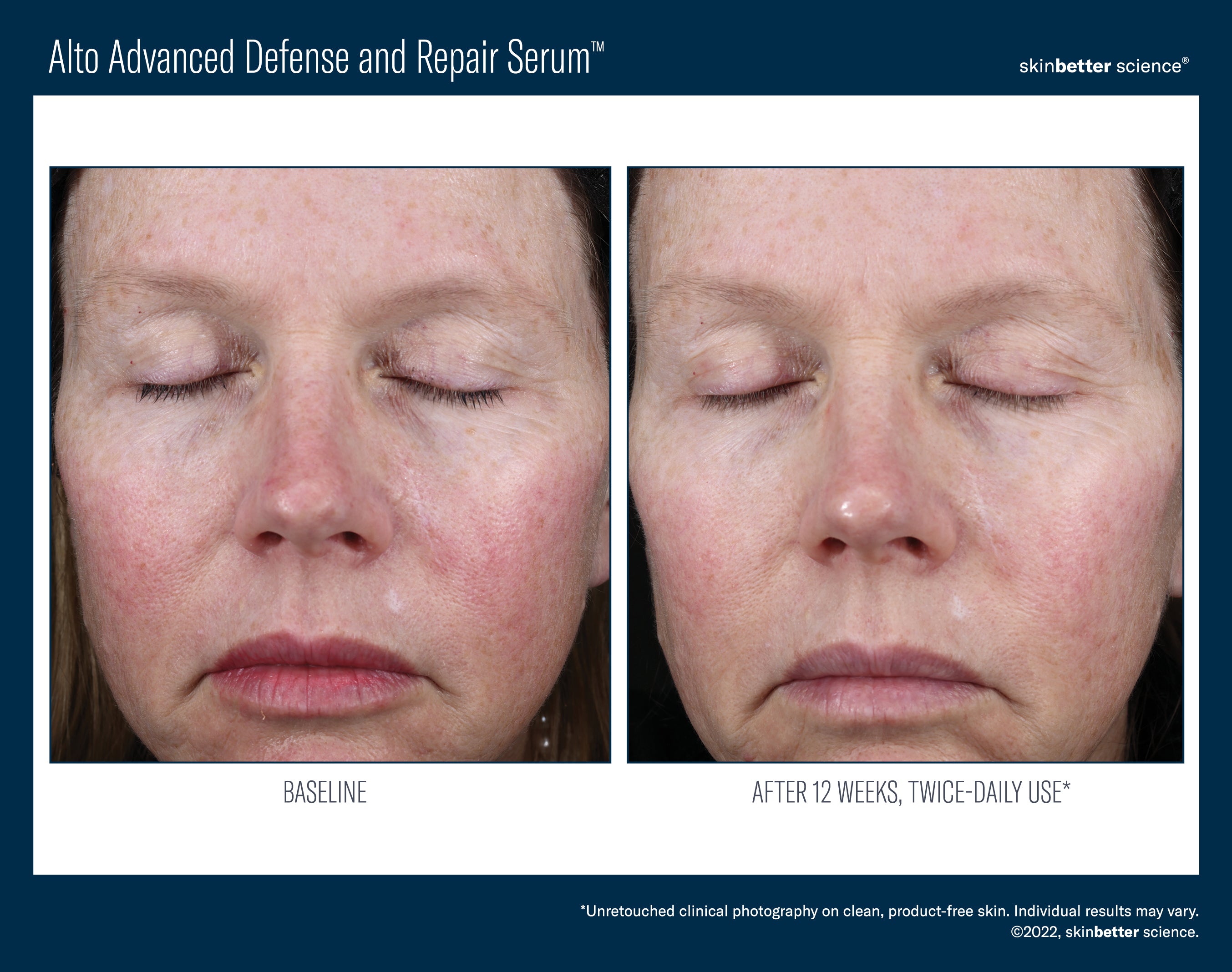 Alto Advanced Defense and Repair Serum