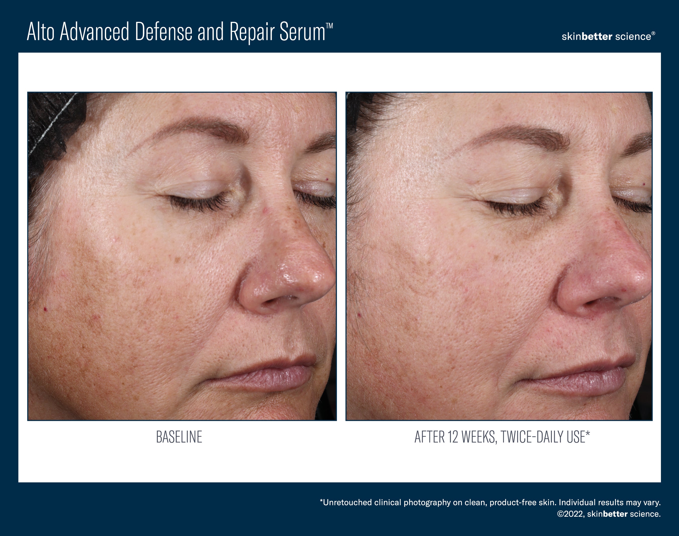 Alto Advanced Defense and Repair Serum
