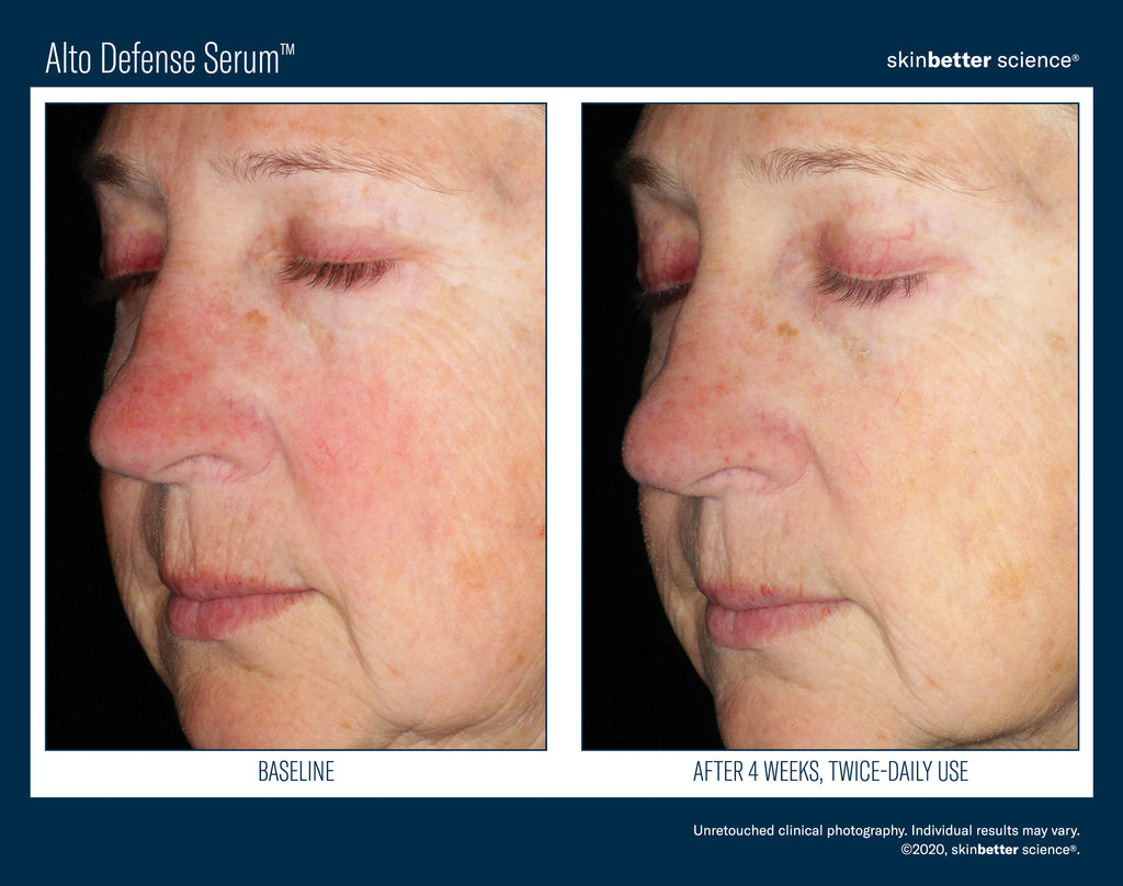 Alto Advanced Defense and Repair Serum