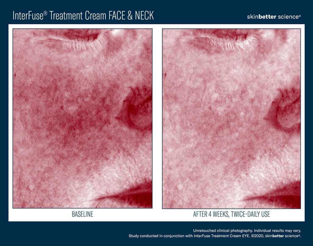 InterFuse Treatment Cream Face & Neck