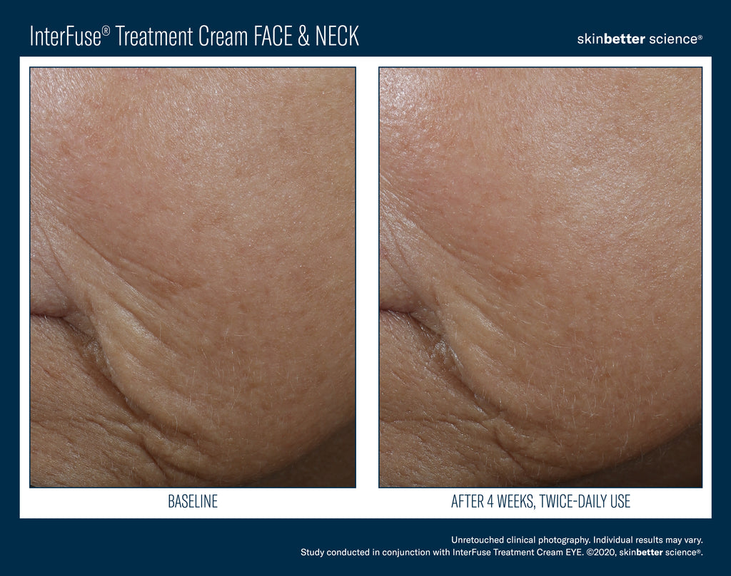 InterFuse Treatment Cream Face & Neck
