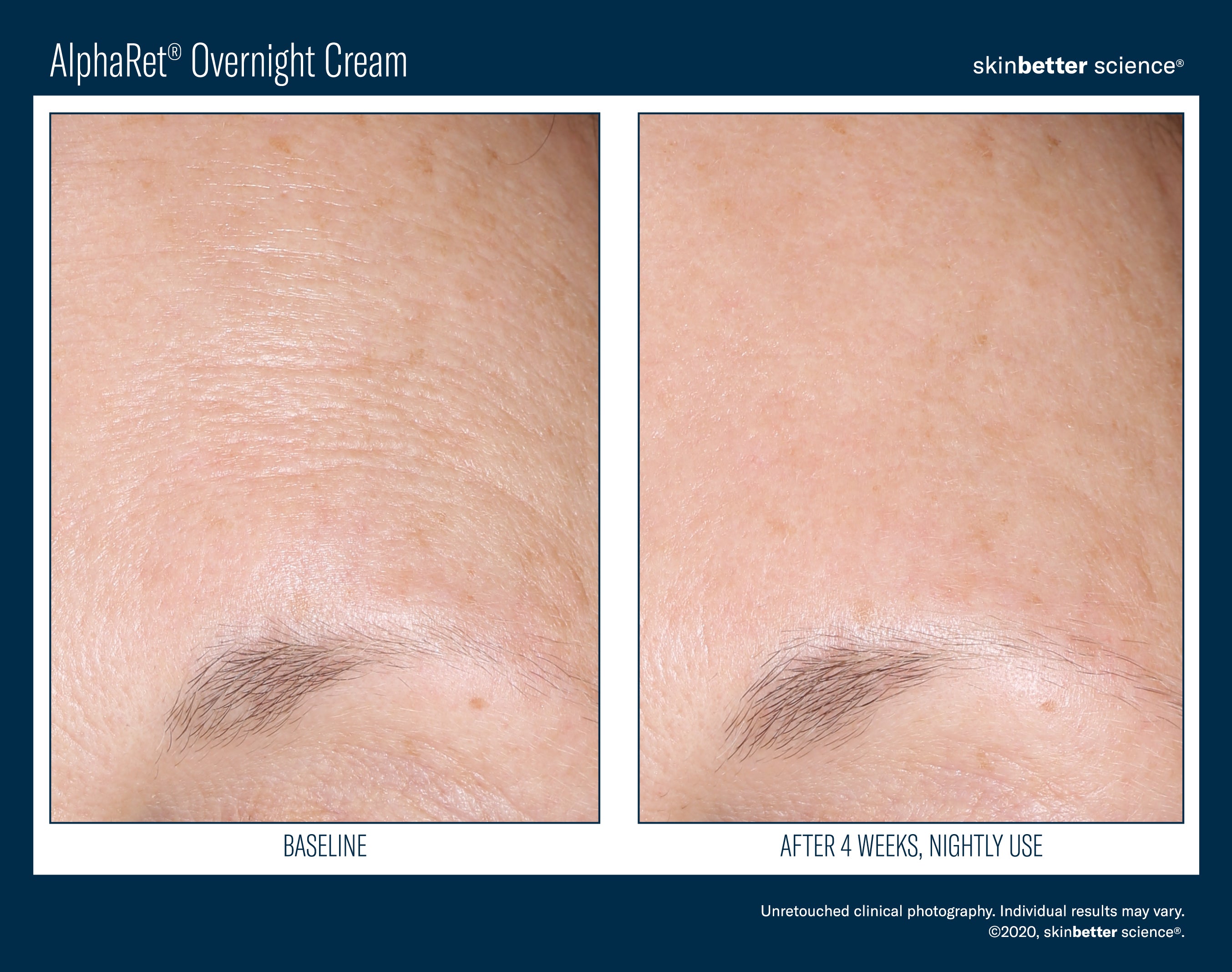 AlphaRet Overnight Cream