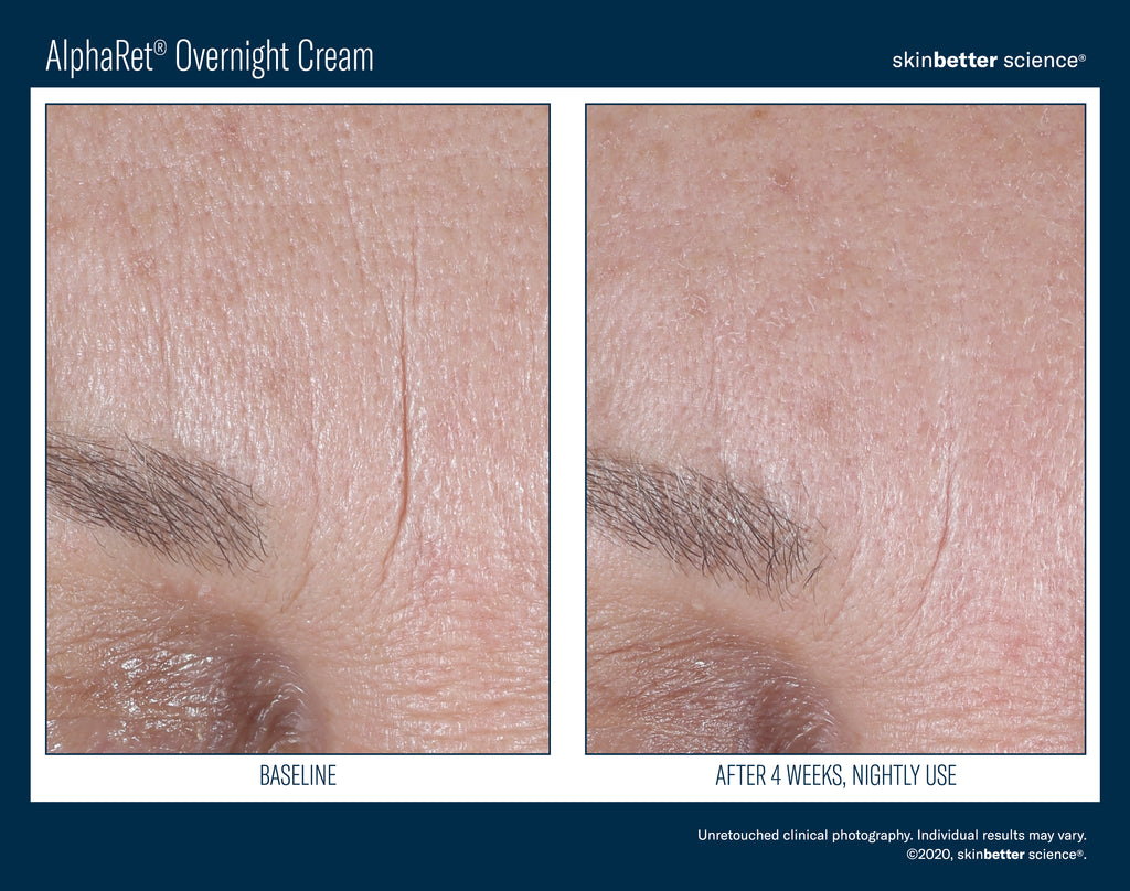 AlphaRet Overnight Cream