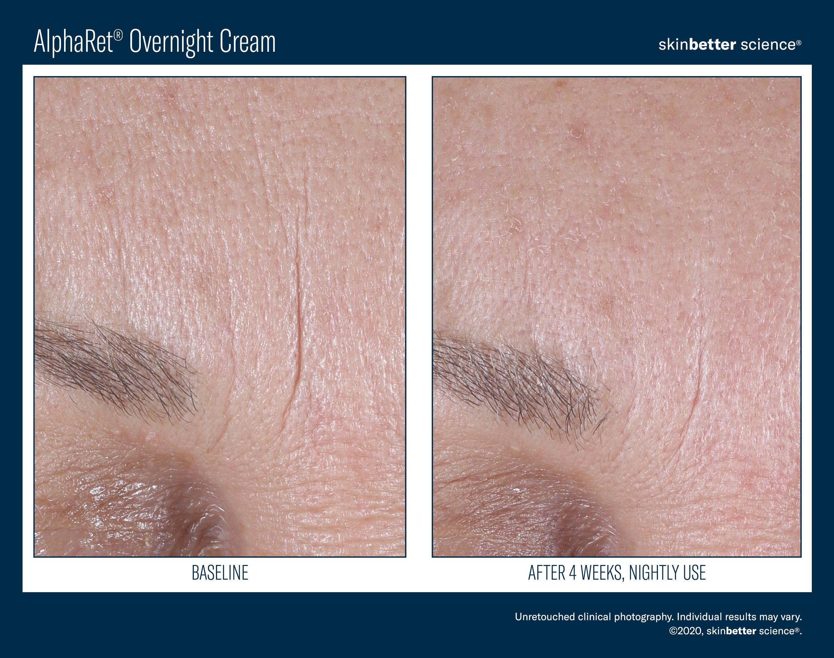 AlphaRet Overnight Cream