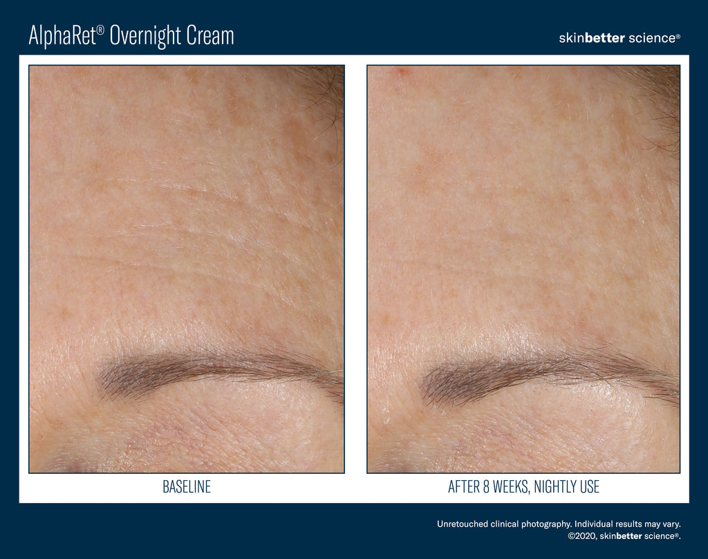 AlphaRet Overnight Cream