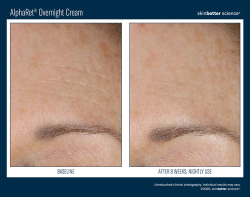 AlphaRet Overnight Cream